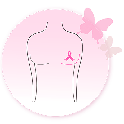 Breast reconstruction